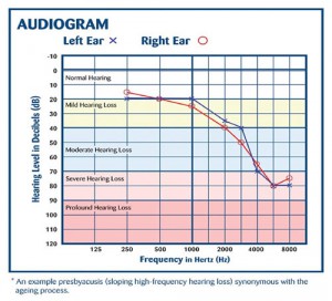 Audiogram Hearing Test Results