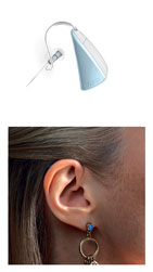 Open Hearing Aid Open Ear